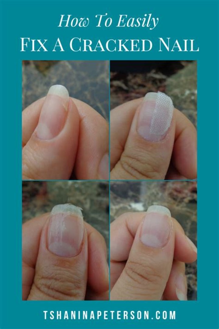 Can you fix a cracked nail?