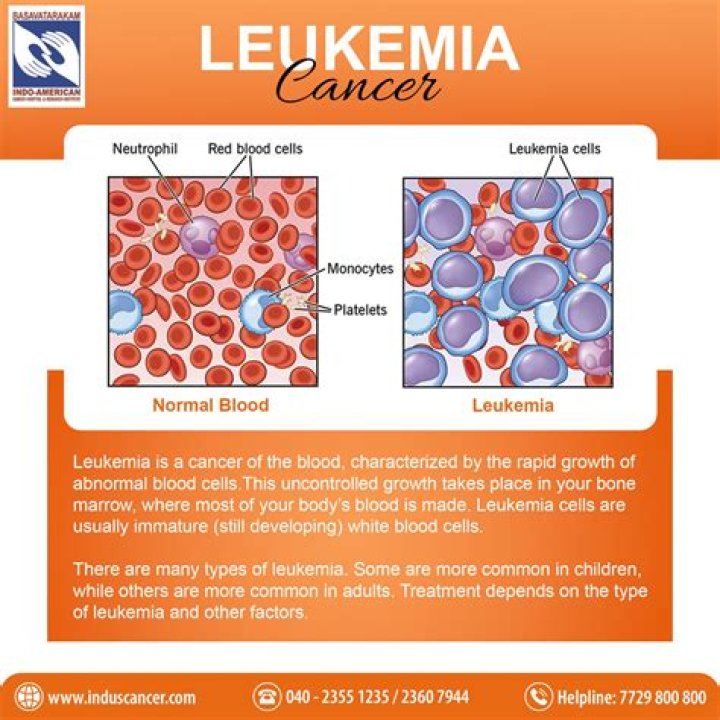 Does radiation cause leukemia?