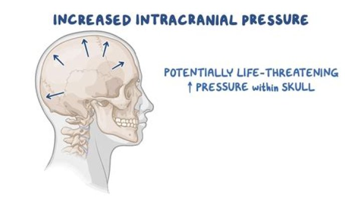 How do you relieve intracranial pressure?