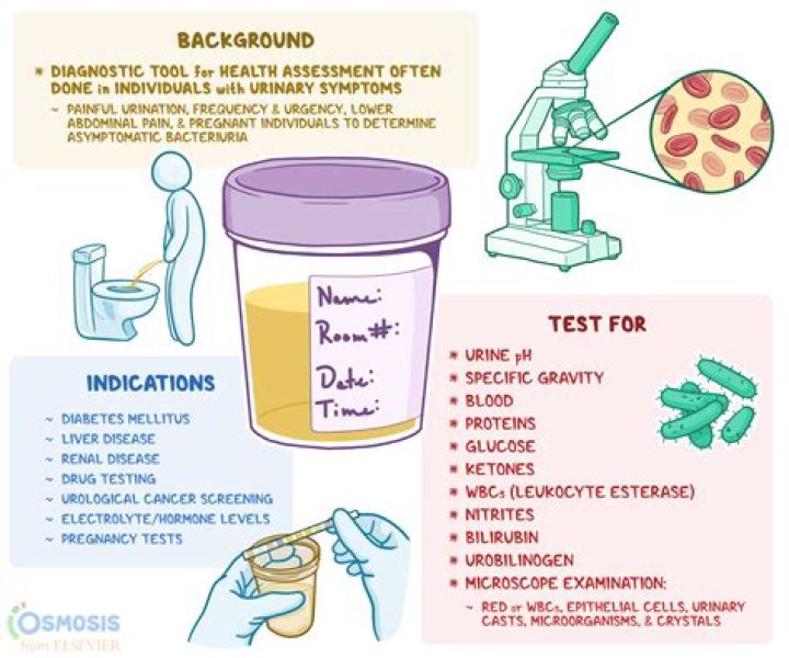 How much urine is needed for UA C&S?