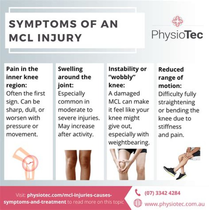 How serious is MCL sprain?