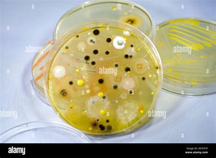 Is halobacterium Salinarum helpful?