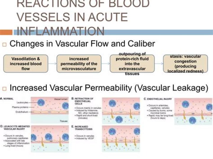 What causes increased permeability of blood vessels during acute inflammation?