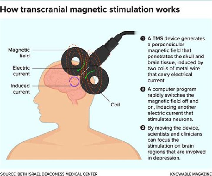 What does electrical stimulation of the brain ESB involve?