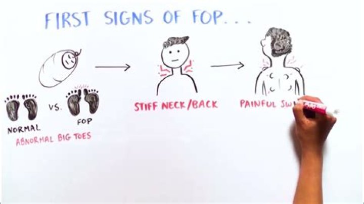 What does ROPS and FOPS stand for?