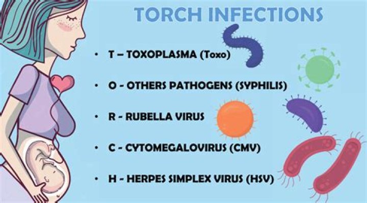 What does torch stand for in pregnancy?
