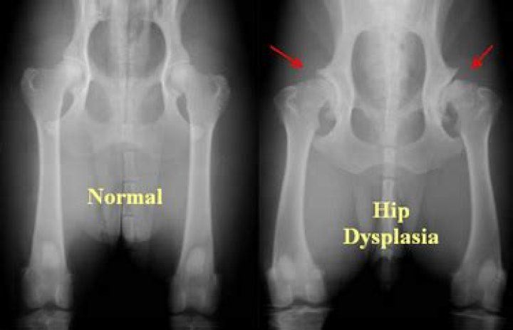 What is canine hip dysplasia?