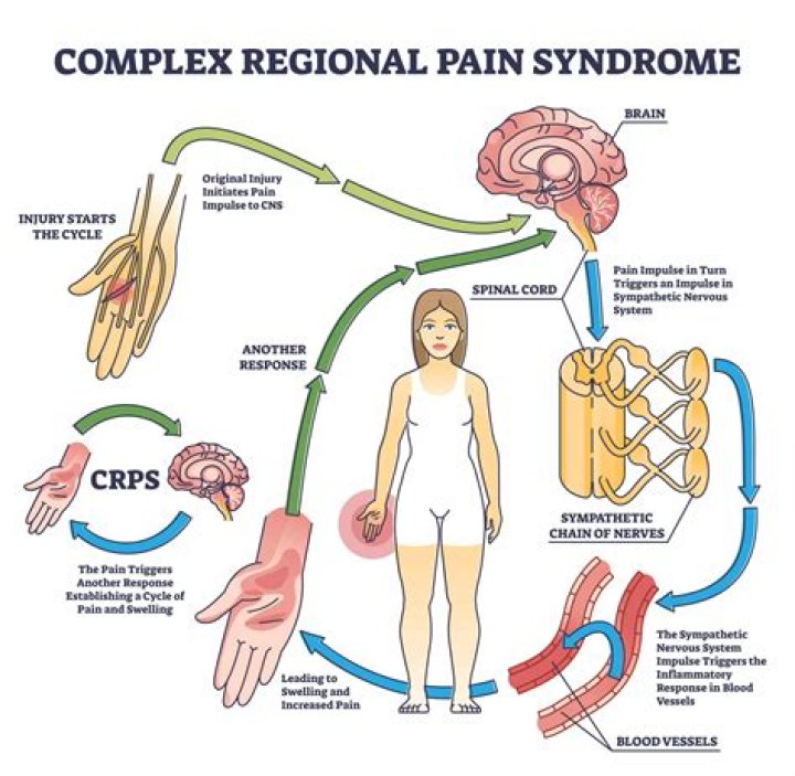 What is CRPS finance?