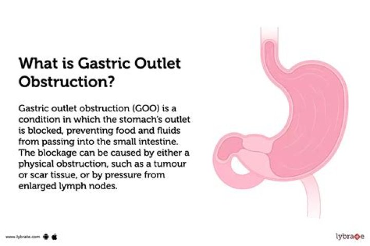What is gastric occult blood?