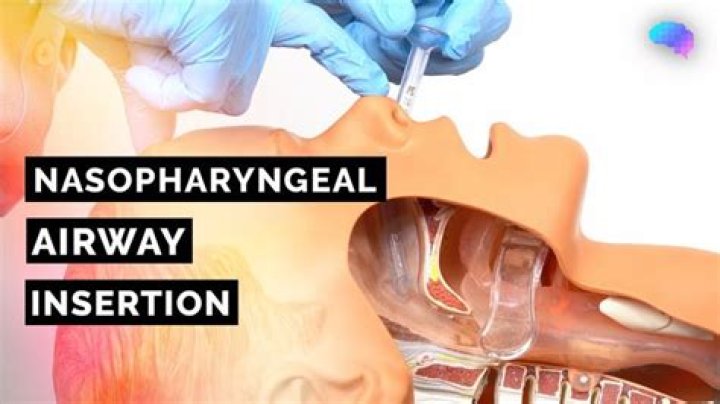 What is the most common complication after inserting an oral airway?