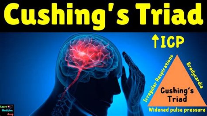 What position does Brian Cushing play?